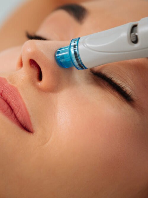 Hydrafacial